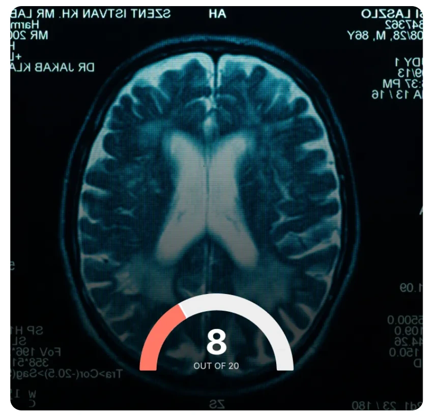 Segtnan Brain Score